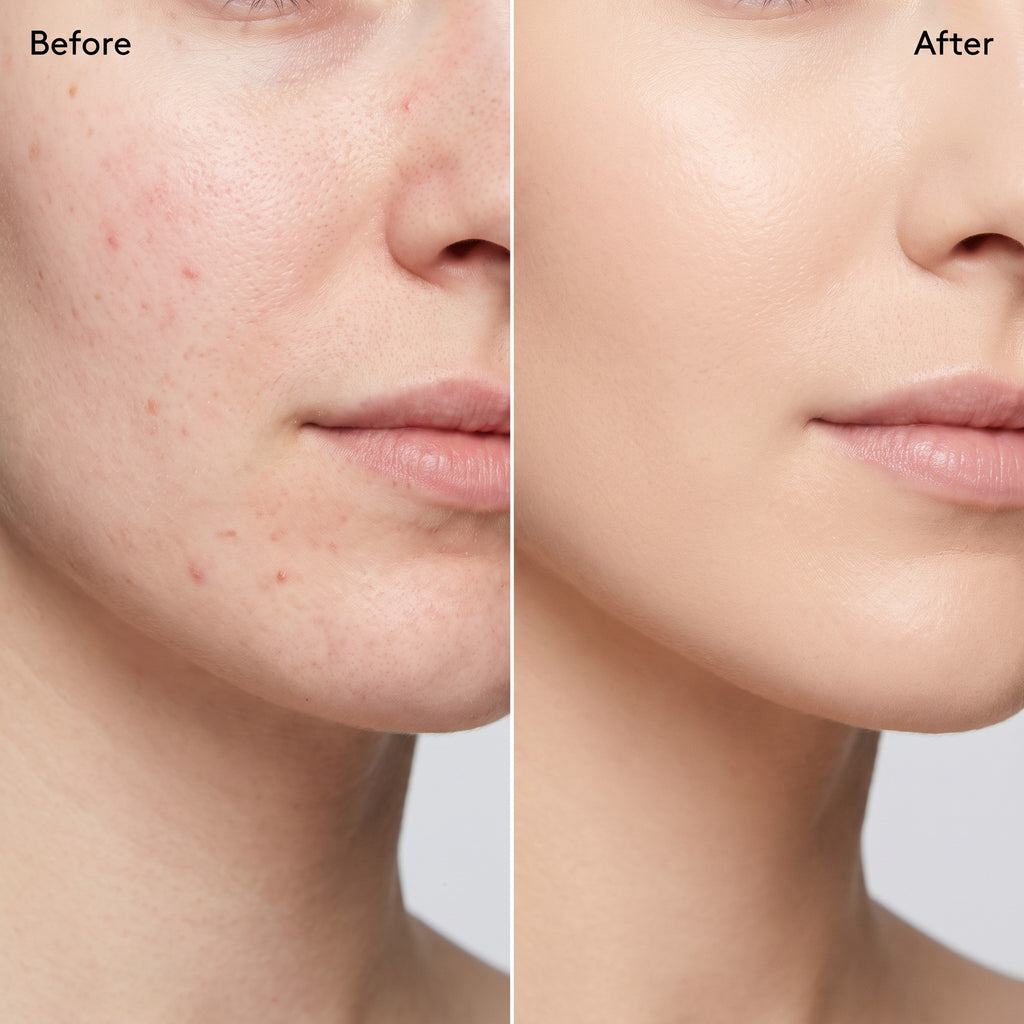 Polite Foundation before and after