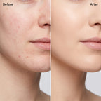 Polite Foundation before and after